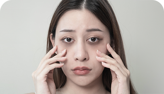 Kobieta z ciemnymi cieniami pod oczami, dotykająca palcami policzków, wyrażająca zmęczenie