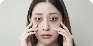 Kobieta z ciemnymi cieniami pod oczami, dotykająca palcami policzków, wyrażająca zmęczenie